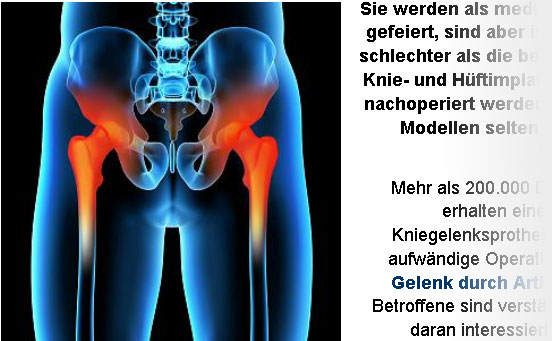 Neue Knie- und HÃ¼ftimplantate schlechter als alte